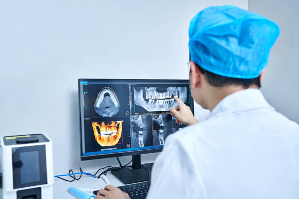 Best Emergency Wisdom Teeth Removal in Thompsons Station, TN